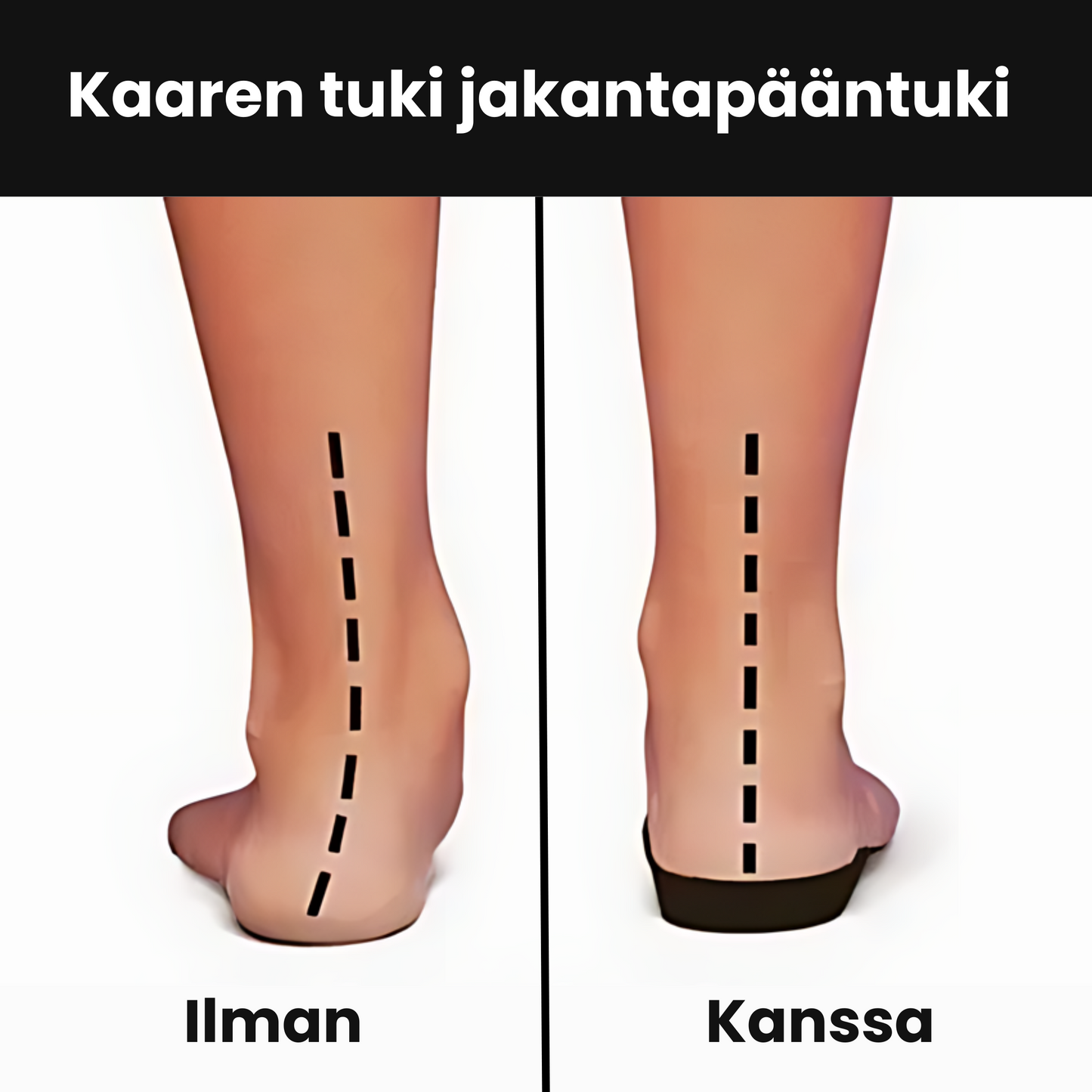 Ortopediset Slip-on-Kengät